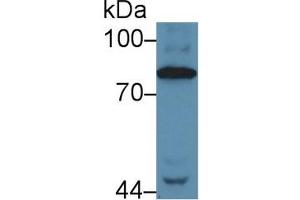 Detection of C4 in Human Serum using Polyclonal Antibody to Complement Component 4 (C4) (Complement C4 抗体  (AA 975-1336))