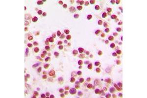 Immunohistochemistry (IHC) image for anti-BTB and CNC Homology 1, Basic Leucine Zipper Transcription Factor 1 (BACH1) (Center) antibody (ABIN7294994)