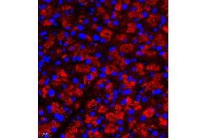 Immunofluorescence (Paraffin-embedded Sections) (IF (p)) image for anti-Ras-Related C3 Botulinum Toxin Substrate 3 (Rho Family, Small GTP Binding Protein Rac3) (RAC3) antibody (ABIN7075378)