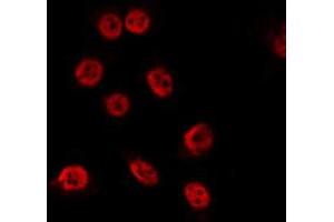 ABIN6274059 staining COS7 by IF/ICC. (TP53BP1 抗体  (pThr543))