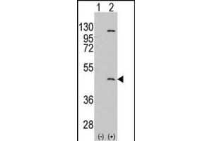 Western blot analysis of PRMT8 (arrow) using rabbit polyclonal PRMT8 Antibody (C-term) (ABIN388025 and ABIN2845473). (PRMT8 抗体  (C-Term))