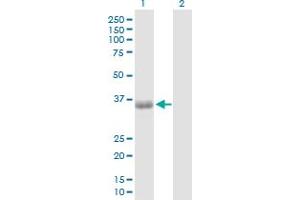 Western Blot analysis of PHF11 expression in transfected 293T cell line by PHF11 MaxPab polyclonal antibody. (PHF11 抗体  (AA 1-292))