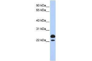WB Suggested Anti-AK1 Antibody Titration:  0. (Adenylate Kinase 1 抗体  (Middle Region))