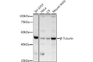 Western blot analysis of extracts of various cell lines, using β-Tubulin antibody (ABIN3020552, ABIN3020553 and ABIN3020554) at 1:1000 dilution. (TUBB 抗体  (AA 40-260))