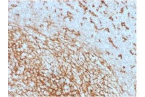 ABIN6383875 to CD14 was successfully used to stain membranes of macrophages in human lymph node and tonsil sections. (CD14 抗体  (Extracellular Domain))