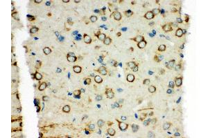 Anti-XRCC3 antibody, IHC(P) IHC(P): Rat Brain Tissue (XRCC3 抗体  (C-Term))