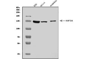 Western blot analysis of KIF5A using anti-KIF5A antibody (ABIN7601527).