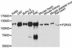 Western blot analysis of extracts of various cell lines, using P2RX5 antibody. (P2RX5 抗体)