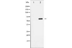 Western blot analysis of Cyclin B1 phosphorylation expression in UV treated Jurkat whole cell lysates,The lane on the left is treated with the antigen-specific peptide.