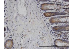 Immunoperoxidase of monoclonal antibody to USP45 on formalin-fixed paraffin-embedded human small Intestine. (USP45 抗体  (AA 106-196))