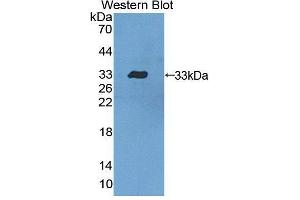 Western blot analysis of the recombinant protein. (Dystrobrevin beta 抗体  (AA 1-249))
