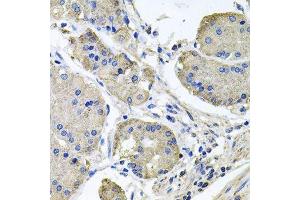 Immunohistochemistry of paraffin-embedded human stomach using NDUFA6 antibody. (NDUFA6 抗体  (AA 35-154))