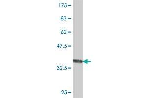 Western Blotting (WB) image for anti-BRF2, Subunit of RNA Polymerase III Transcription Initiation Factor, BRF1-Like (BRF2) (AA 1-100) antibody (ABIN565854)