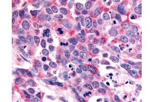 Immunohistochemistry (IHC) image for anti-Olfactory Receptor, Family 6, Subfamily K, Member 3 (OR6K3) (N-Term) antibody (ABIN1049185)