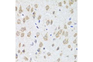 Immunohistochemistry of paraffin-embedded mouse brain using CXCL8 antibody (ABIN6290535) at dilution of 1:100 (40x lens). (IL-8 抗体)