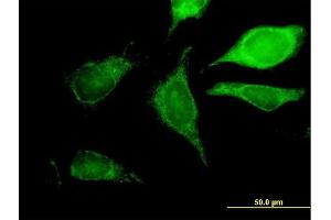 Immunofluorescence of purified MaxPab antibody to GCDH on HeLa cell. (GCDH 抗体  (AA 1-438))