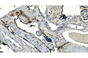 IHC analysis of TMBIM1 using anti-TMBIM1 antibody (ABIN7603190). (TMBIM1 抗体  (N-Term))