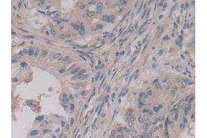 Immunohistochemistry (IHC) image for anti-Annexin A11 (ANXA11) (AA 1-505) antibody (ABIN7435868)
