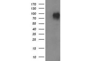 HEK293T cells were transfected with the pCMV6-ENTRY control (Left lane) or pCMV6-ENTRY VCAM1 (Right lane) cDNA for 48 hrs and lysed. (VCAM1 抗体)