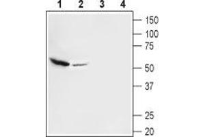Western blot analysis of mouse (lanes 1 and 3) and rat (lanes 2 and 4) brain membranes: - 1,2. (SLC17A8 抗体  (C-Term, Cytosolic))