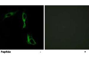 Immunofluorescence analysis of HeLa cells, using ADRA1D polyclonal antibody . (ADRA1D 抗体)