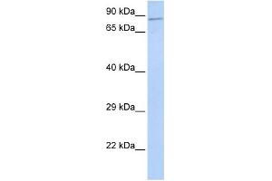 WB Suggested Anti-ZNF226 Antibody Titration:  0. (ZNF226 抗体  (Middle Region))