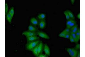 Immunofluorescent analysis of Hela cells using ABIN7145827 at dilution of 1:100 and Alexa Fluor 488-congugated AffiniPure Goat Anti-Rabbit IgG(H+L) (TNFAIP1 抗体  (AA 233-316))
