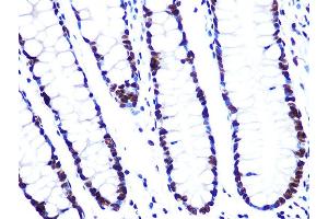 Immunohistochemistry of paraffin-embedded human colon using L Rabbit mAb (ABIN7270266) at dilution of 1:100 (40x lens). (ASH2L 抗体)