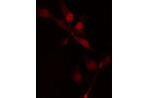 ABIN6274474 staining HepG2 cells by IF/ICC. (MASTL 抗体  (C-Term))
