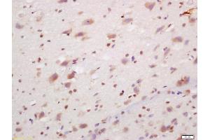 Formalin-fixed and paraffin embedded rat brain labeled with Anti-PCP4/PEP-19 Polyclonal Antibody, Unconjugated (ABIN1385742) at 1:200, followed by conjugation to the secondary antibody and DAB staining (PCP4 抗体  (AA 21-62))