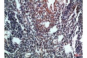 Immunohistochemical analysis of paraffin-embedded Human-tonsil, antibody was diluted at 1:100 (CD8 抗体  (AA 100-160))