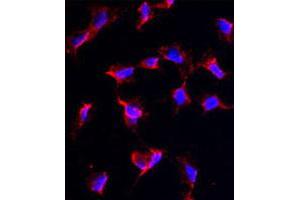 Immunofluorescence analysis of NANOS1 polyclonal antibody  in HeLa cells. (Nanos Homolog 1 抗体  (C-Term))