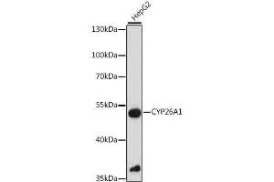 Western blot analysis of extracts of HepG2 cells, using CYP26 antibody (6259) at 1:1000 dilution. (CYP26A1 抗体  (AA 50-150))