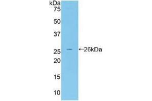 Western blot analysis of recombinant Mouse FBLN2. (FBLN2 抗体  (AA 896-1106))