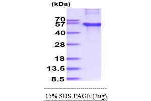 SDS-PAGE (SDS) image for CAMP Responsive Element Binding Protein 3-Like 2 (CREB3L2) (AA 1-378) protein (His tag) (ABIN6387528) (CREB3L2 Protein (AA 1-378) (His tag))