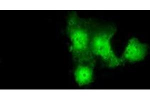 Anti-GBE1 mouse monoclonal antibody (ABIN2453066) immunofluorescent staining of COS7 cells transiently transfected by pCMV6-ENTRY GBE1 (RC204152). (GBE1 抗体)