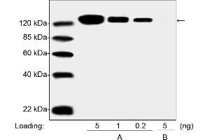 Western blot analysis of PEGylated drug (Pegasys, Peginterferon Alfa 2A) and Non-PEGylated Interferon Alfa 2A protein using the PEG Antibody [Biotin], mAb, Mouse (0. (PEG 抗体  (Biotin))