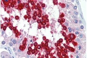 Human Testis (formalin-fixed, paraffin-embedded) stained with JAZF1 antibody ABIN462223 followed by biotinylated goat anti-rabbit IgG secondary antibody ABIN481713, alkaline phosphatase-streptavidin and chromogen. (JAZF1 抗体  (C-Term))