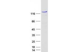 Western Blotting (WB) image for Signal Transducer and Activator of Transcription 2, 113kDa (STAT2) protein (Myc-DYKDDDDK Tag) (ABIN2732778)
