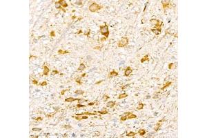 Immunohistochemistry of paraffin embedded mouse epencephalon using AMIGO2 (ABIN7072966) at dilution of 1: 1300 (400x lens)