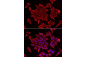 Immunofluorescence analysis of U2OS cell using TIMM17A antibody. (TIMM17A 抗体)