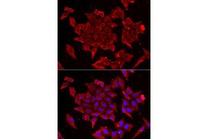 Immunofluorescence analysis of U2OS cell using TIMM17A antibody. (TIMM17A 抗体)