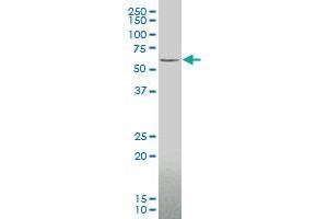 ZIC3 monoclonal antibody (M05), clone 2C1 Western Blot analysis of ZIC3 expression in Y-79 . (ZIC3 抗体  (AA 182-274))