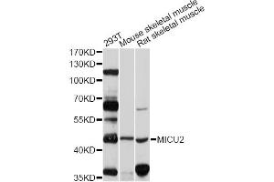Western blot analysis of extracts of various cell lines, using MICU2 antibody (ABIN5998228) at 1/1000 dilution. (EFHA1 抗体)