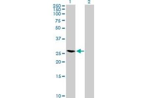 Western Blot analysis of RAB40A expression in transfected 293T cell line by RAB40A MaxPab polyclonal antibody. (RAB40A 抗体  (AA 1-277))