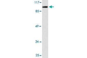 Western blot analysis of A-549 cell lysate with PML polyclonal antibody . (PML 抗体)