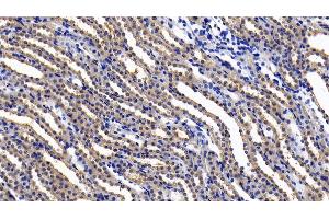 Detection of IL11Ra in Rat Kidney Tissue using Polyclonal Antibody to Interleukin 11 Receptor Alpha (IL11Ra)