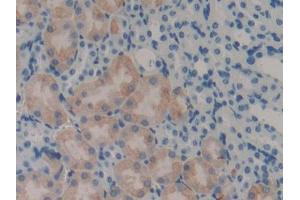 DAB staining on IHC-P; Samples: Mouse Kidney Tissue (LECT2 抗体  (AA 1-151))