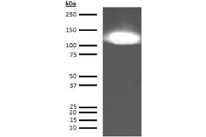 Western Blotting (WB) image for anti-KININOGEN HMW antibody (ABIN613715) (KININOGEN HMW 抗体)