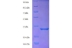 SDS-PAGE (SDS) image for Metallothionein 1 (MT1) (AA 1-60), (full length) protein (His-SUMO Tag) (ABIN5710948)